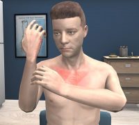 A young adult man is in a doctor's office. Red burn marks are visible on the upper chest and right hand.